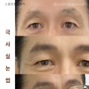 스칼프랩앤뷰티 속눈썹&눈썹&탈모 의정부점 이미지