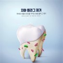 민플러스치과의원 | 동작구치과 알아보다가 결국 정착한 서울민플러스치과