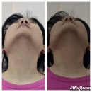 힐링 2코스 | 을지로 체형교정 김기숙 힐링숍 스페셜 코스 후기 동대문마사지, 종로마사지