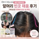 T.M오토밋션 | 분당 헤어라인 뷰티눈썹ㅣ 앞머리 빈 부분 두피메이크업 직접 받아본 후기