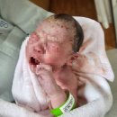 봄빛 안경 | 봄빛병원 초산모 유도분만 출산 후기(유도 성공! but...)