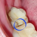인덕원신준세치과의원 | 돈가스 사줄게 하고 치과가는 건 국룰 이잖오 : 신준세치과
