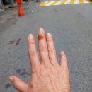 75. 손 피해증거 사진과 대처법- 최소한 자신이 어떤 사람인가는 알게 될 것이며 방금 중요링크 추가했음 이미지