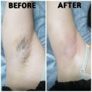 왁싱이지 Waxing easy | 창원왁싱 waxing 겨드랑이왁싱 창원용호동 Easy뷰티#