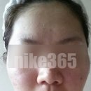 리유 - 화성시 동탄첨단산업2로 14 | 리유한의원 신촌점 다녀본 여드름 한의원 후기