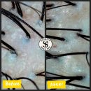 스텔라바디핏 | 부산 헤드스파 잘하는 곳, 광안리 스킨핏헤드스파 커플 두피마사지 후기