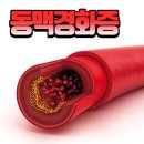 경화 이미지