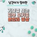 피부 기묘증 원인 증상 묘기증 치료 이미지