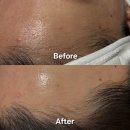 봉곡로-12 | 구미피부관리 구미스킨플래닝 봉곡동피부관리 디어모먼트뷰티 후기