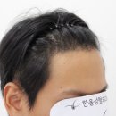 더헤어라인성형외과의원 이미지