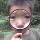 1회 사진기록전 | 창원문신제거 올드스쿨 문신제거 1회차 후기 (레이저 전,후사진포함)