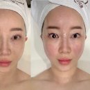 인천대입구역 2번출구 | [송도웨딩관리] 송도피부관리 목미인골드스파 방문 후기✨