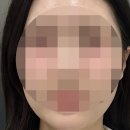 하이즈 | 하이즈앳의원 온다9만줄 3회 내돈내산 후기