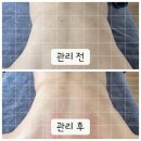 도봉-도봉-서울도봉-2366 | [산후조리] 늦기전에 복직근이개 잡아주고, 뭉친 곳 풀어주는 노원 도봉 출장산후마사지 위더스산후케어