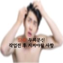 두피문신 받기 전 후 지켜야될 사항 이미지