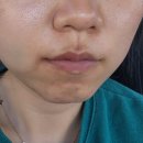 수성사랑니치과의원 이미지