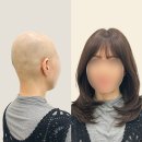 시흥 항암가발 후기｜자연스러운 커트 디자인으로 일상처럼 편안한 맞춤가발