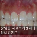 서울프리벤치과의원 이미지