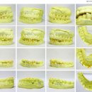 바른치과기공소 이미지