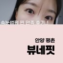 뷰네핏
