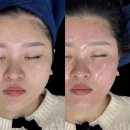 제이에스(JS)메디칼 | [공지] 목포슈퍼젝션 1위, 제이에스뷰티 주원장이 알려드리는 슈퍼젝션 직접 답해드립니다!