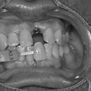 신원치과기공소 이미지