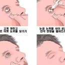 결막염 눈병 원인 증상 안구건조증 안약 치료 안연고 사용법 이미지