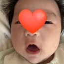 최정미 | 100일 전 아기 콧물·기침 감기, 병원 가야 할까? 80일 아기 울산 소아과 진료 후기