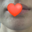수에스테테틱 이미지
