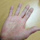 힐스템생활건강 이미지