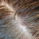 엘에이치팜 이미지