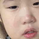 애플치과의원 | [육아] 분당 분당동 분당어린이치과의원; 불소도포 및 충치치료 잘하는 소아치과