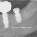 연희세브란스치과의원 이미지