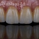 가산치과기공소 이미지