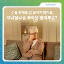 주식회사 한진에셋 | 부산안과 백내장 수술 후 부작용, 망막 부종 원인과 치료방법
