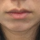 르에이치의원 이미지