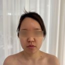 잠실새내역 인하에스테틱 엔더몰로지 얼굴 윤곽관리 솔직후기