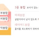 아이에스성형외과의원 네이버블로그