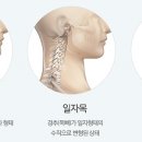 라인카이로프랙틱 이미지