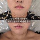 제이앤뷰티 - 김해시 경원로 85 | [덕천 웨딩관리] 제이디앤뷰티 따발팅 후기 :: 결혼 전 이중턱 긴급 처방!
