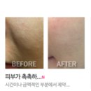 브리예 이미지
