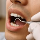 맘애든치과의원 | 부평치과에서 알려주는 스케일링 전후 주의사항