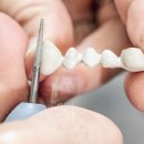 희망치과기공소 이미지