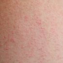 나인피부과의원 이미지