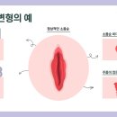 대구봄여성의원 이미지