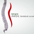 만곡 이미지