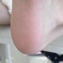 전포 패디플래닝 :: 네일드뉴엘 | 발각질제거 서면 패디플래닝 잘하는곳 추천
