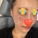 닥터홍가정의학과의원 | 30대 중반 피부관리 잔주름 잔혹사... 셀르디엠 내돈내산 현타 후기(리투오 비교) + 병원 정보 공개