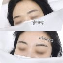 눈썹이날개다 이미지