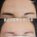 일일구헤어 네이버블로그